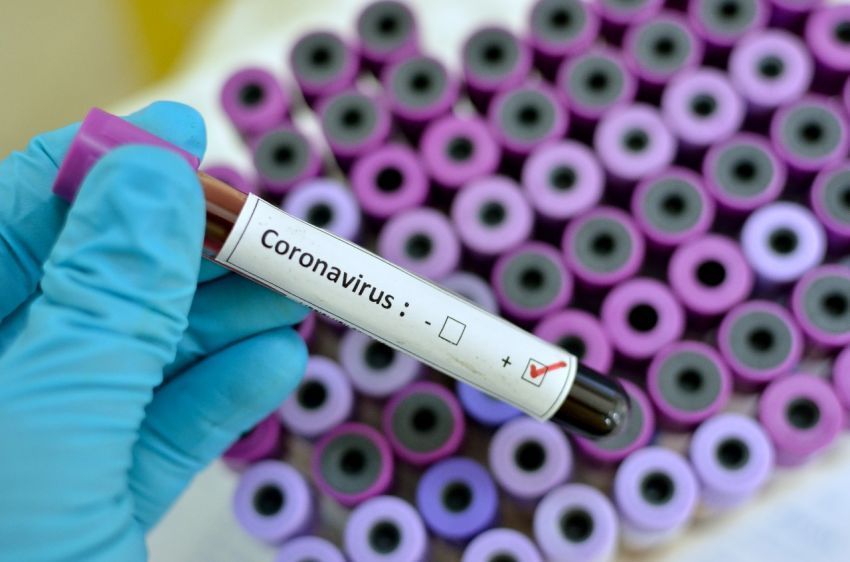 Dez casos confirmados de coronavírus em Sergipe