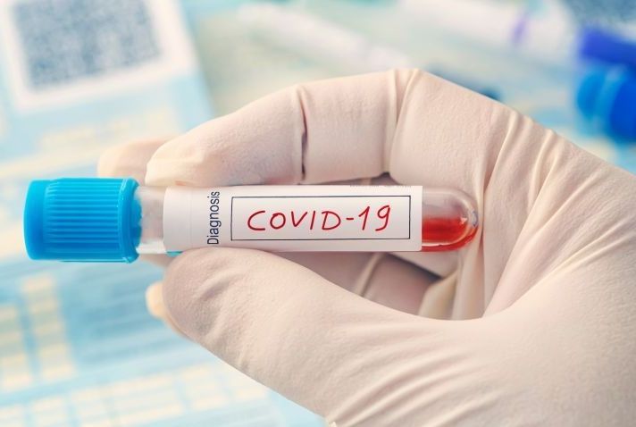 COVID-19: Mais de mil novos casos foram registrados no último domingo