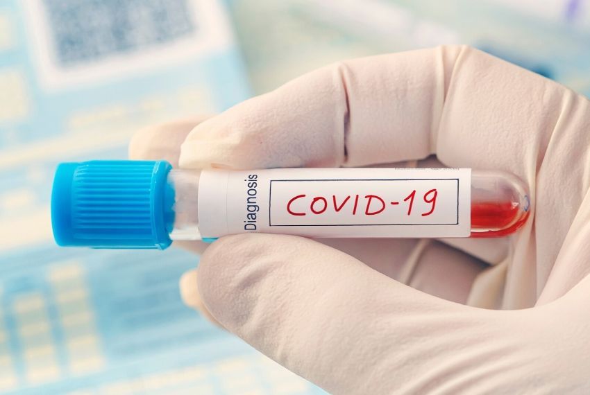 Sergipe registra 697 novos casos de Covid-19 e mais 24 mortes