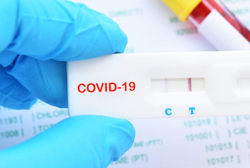Sergipe registra 232 novos casos de Covid-19