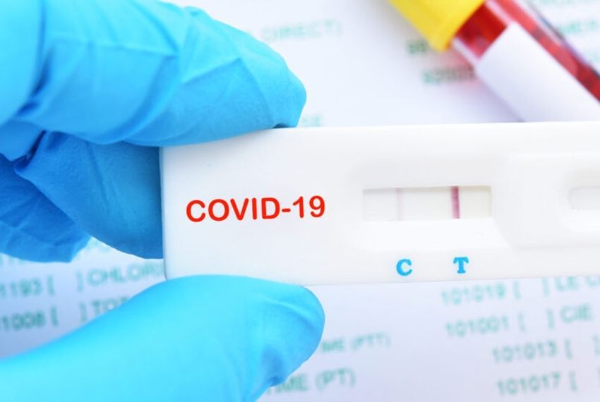 Sergipe registrou  577 casos novos de Covid-19 e um óbito
