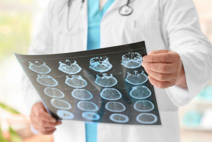 Ipesaúde destaca desafios e avanços no enfrentamento do câncer cerebral