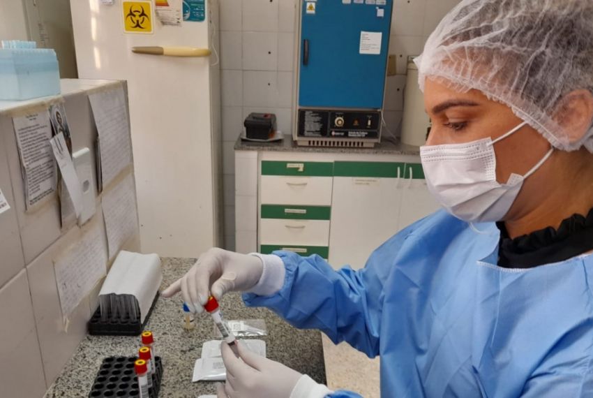Lacen realiza diagnósticos de Leishmaniose em animais e humanos